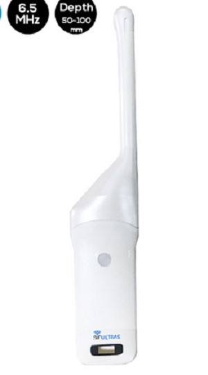 Wireless Transvaginal Ultrasound Scanner FDA SIFULTRAS-5.36